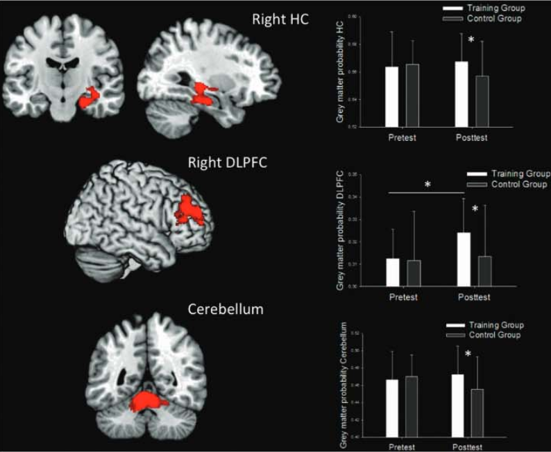 Action video games improve brain function more than so-called 'brain games